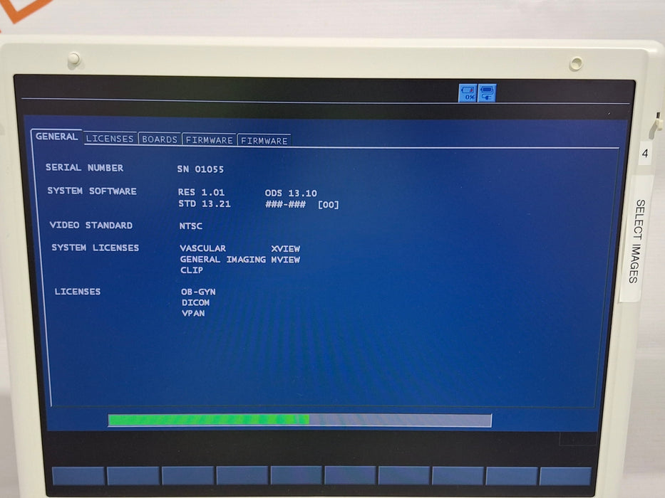 Siemens Acuson P300 Ultrasound