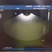 Philips Philips 3D9-3v Endovaginal Transducer Ultrasound Probes reLink Medical