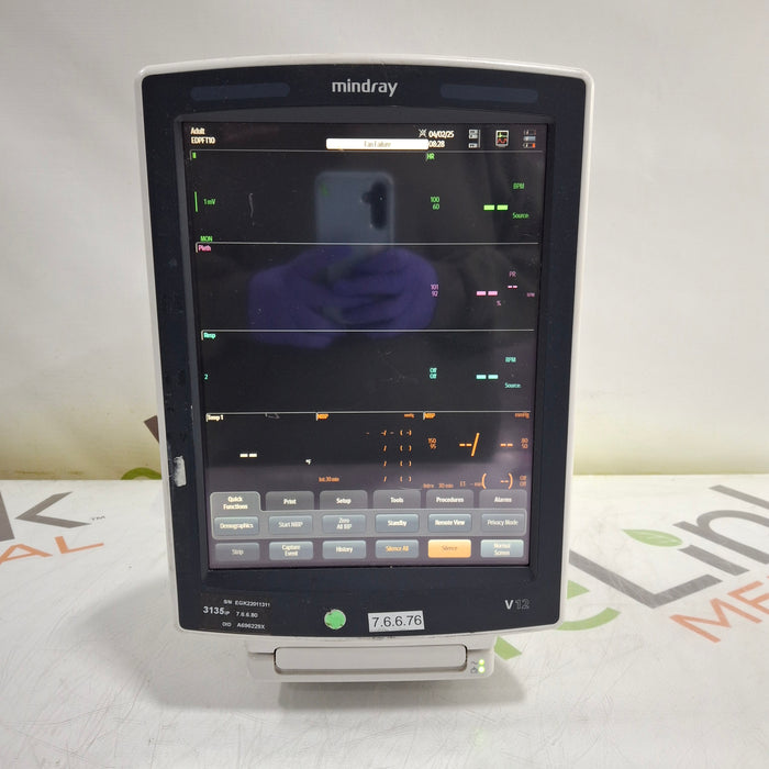 Mindray Mindray V12 Bedside Patient Monitor Patient Monitors reLink Medical