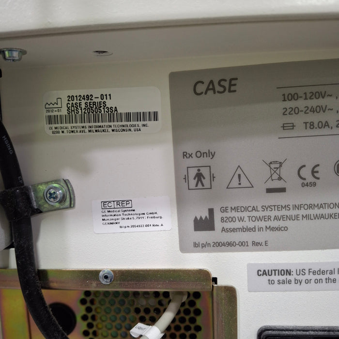 GE Healthcare Case P2 Stress Test Console