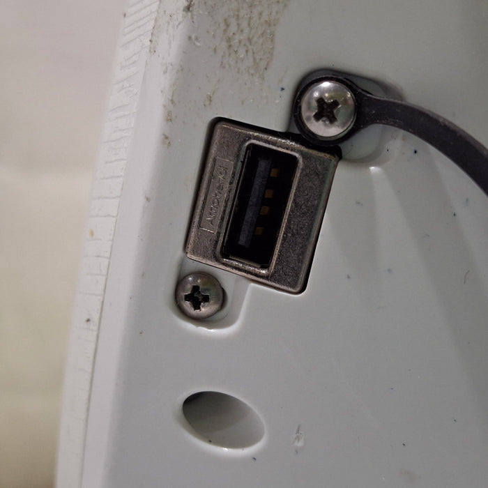 Verathon Medical, Inc Glidescope Video Laryngoscope