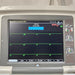 GE Healthcare GE Healthcare MAC 5500 HD ECG with CAM Module Cardiology reLink Medical