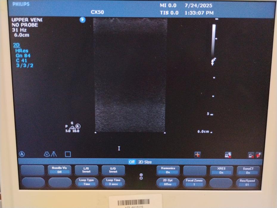 Philips Philips CX50 Ultrasound Ultrasound reLink Medical