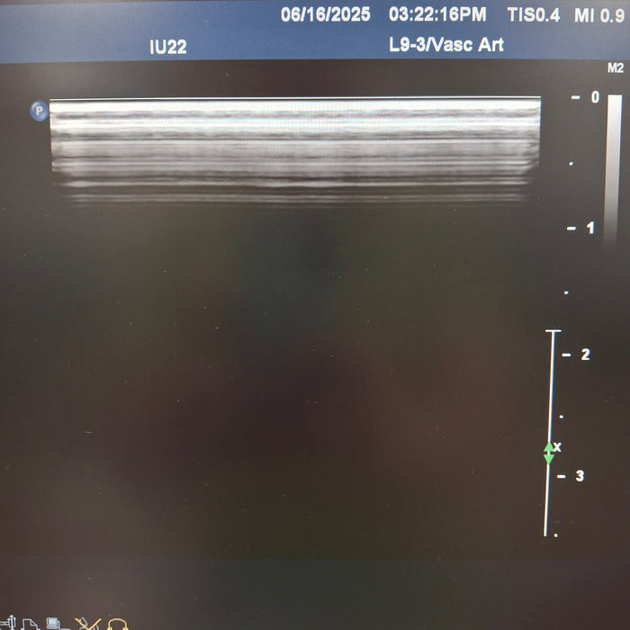 Philips Philips L9-3 Linear Array Transducer Ultrasound Probes reLink Medical