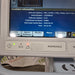 Respironics Respironics V60 BiPAP Ventilator Monitor Respiratory reLink Medical