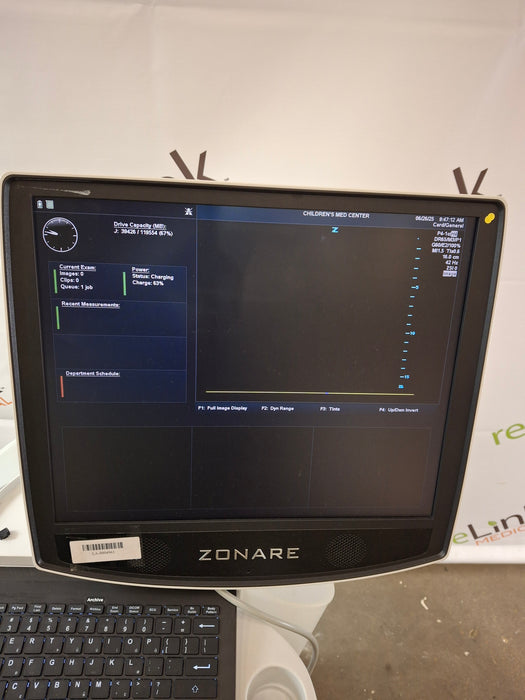 Zonare ZS3 Ultrasound