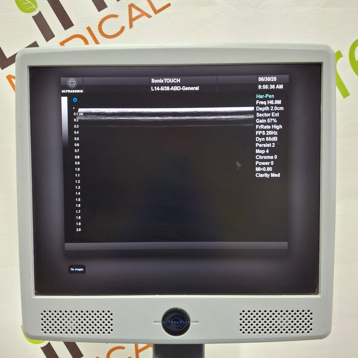 UltraSonix UltraSonix Sonix Touch Ultrasound Ultrasound reLink Medical