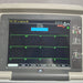 GE Healthcare GE Healthcare MAC 5500 ECG without CAM Module Cardiology reLink Medical