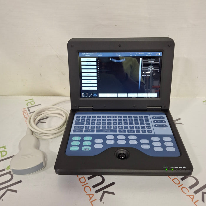Contec Medical Systems Portable Laptop Machine Digital Ultrasound Scanner