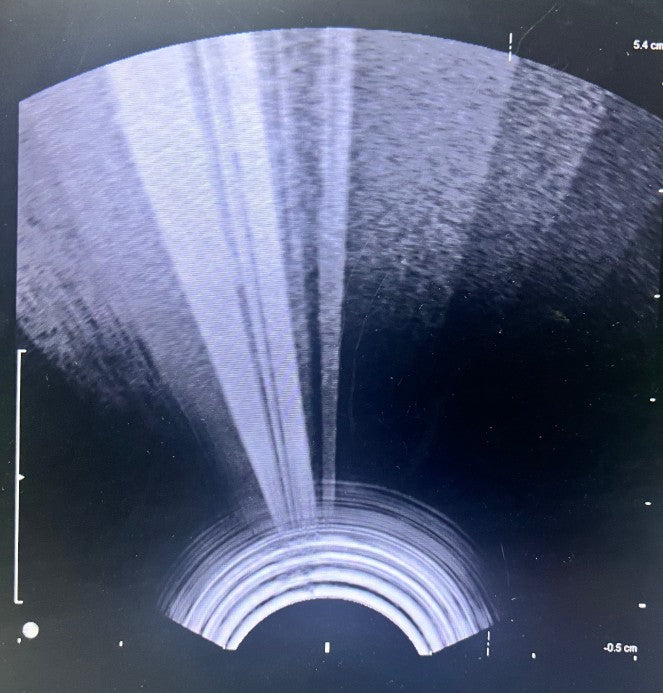 B-K Medical 8808 5-10 MHz Linear Transducer