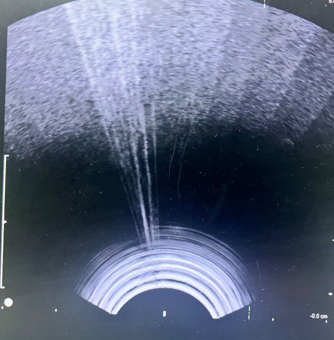 B-K Medical 8808 5-10 MHz Linear Transducer