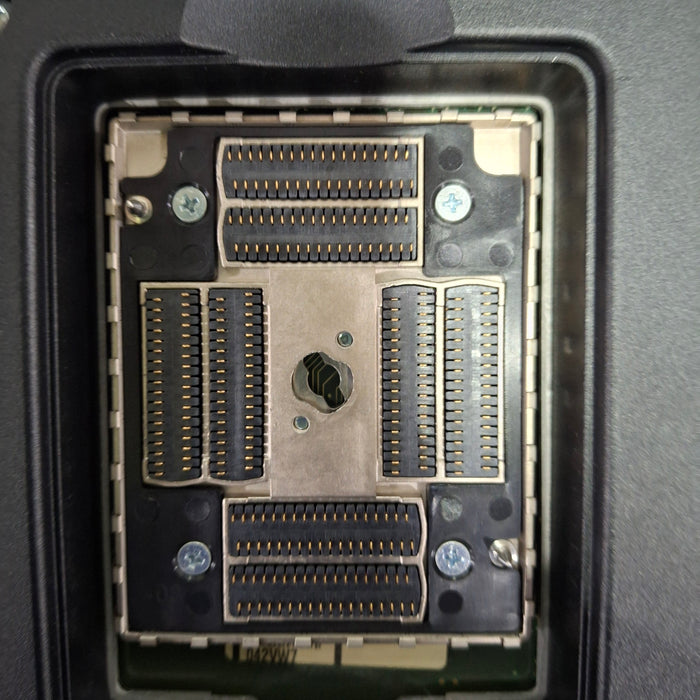 Sonosite X-Porte Ultrasound