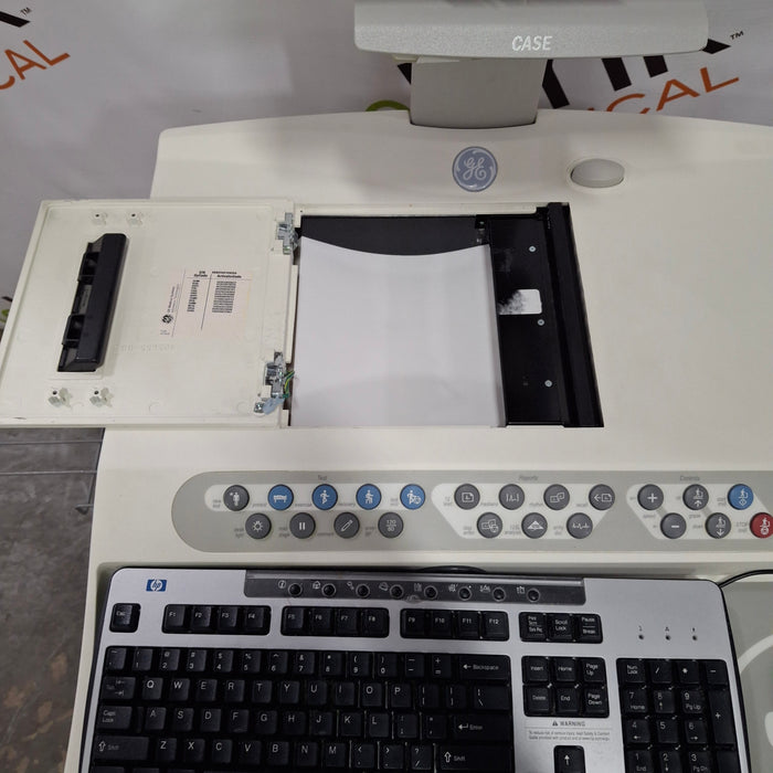 GE Healthcare Case P2 Stress Test Console
