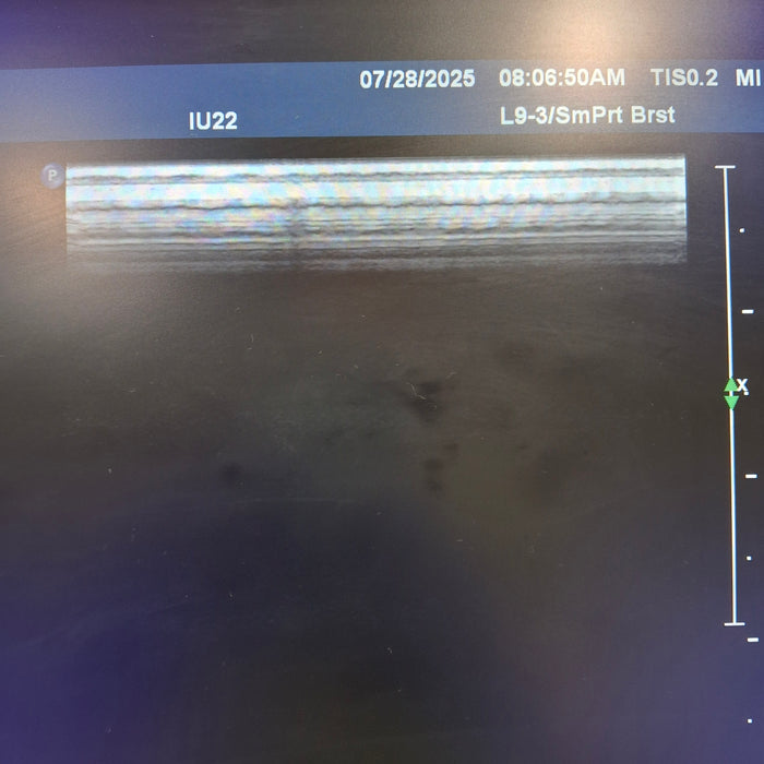Philips L9-3 Linear Array Transducer