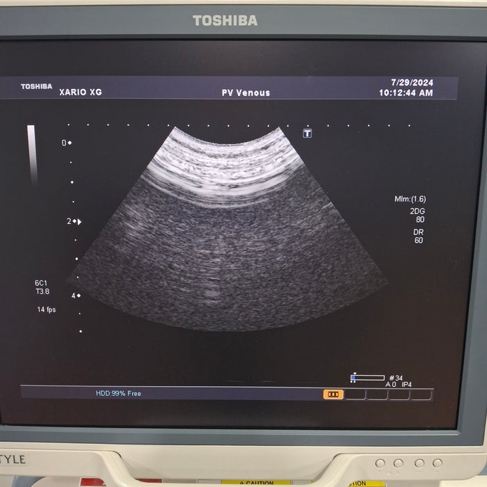 Toshiba Xario XG SSA-680A Ultrasound