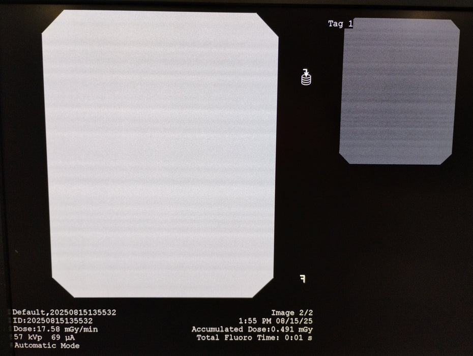 Orthoscan HD 1000-0004 Mini C-Arm