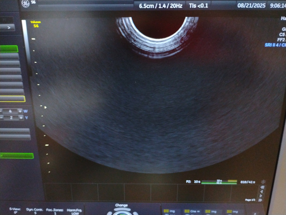 GE Healthcare GE Healthcare Voluson S6 Ultrasound Ultrasound reLink Medical