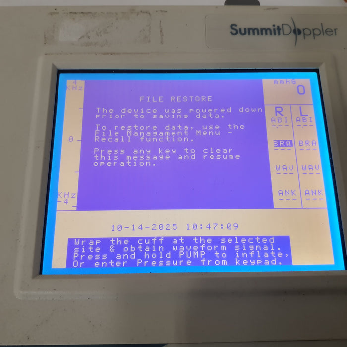 Summit Doppler Vista AVS Advanced Vascular System