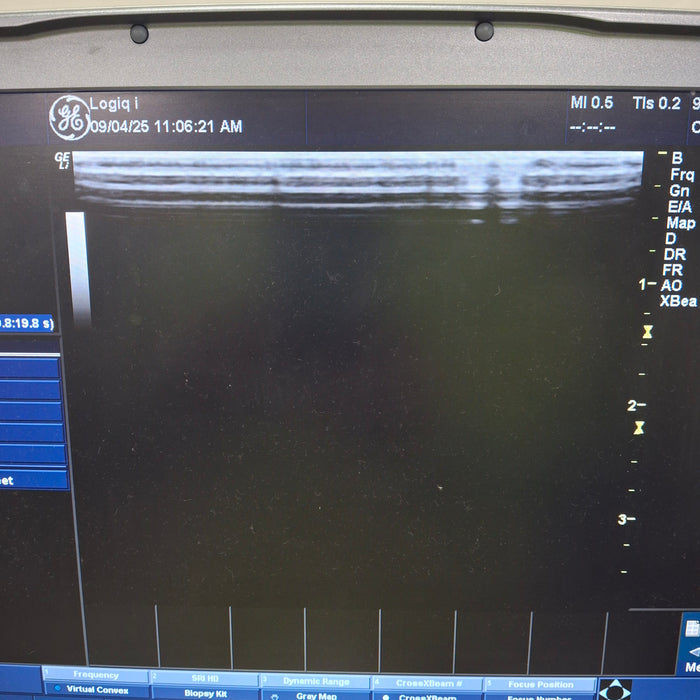 GE Healthcare GE Healthcare Logiq e Ultrasound Ultrasound reLink Medical