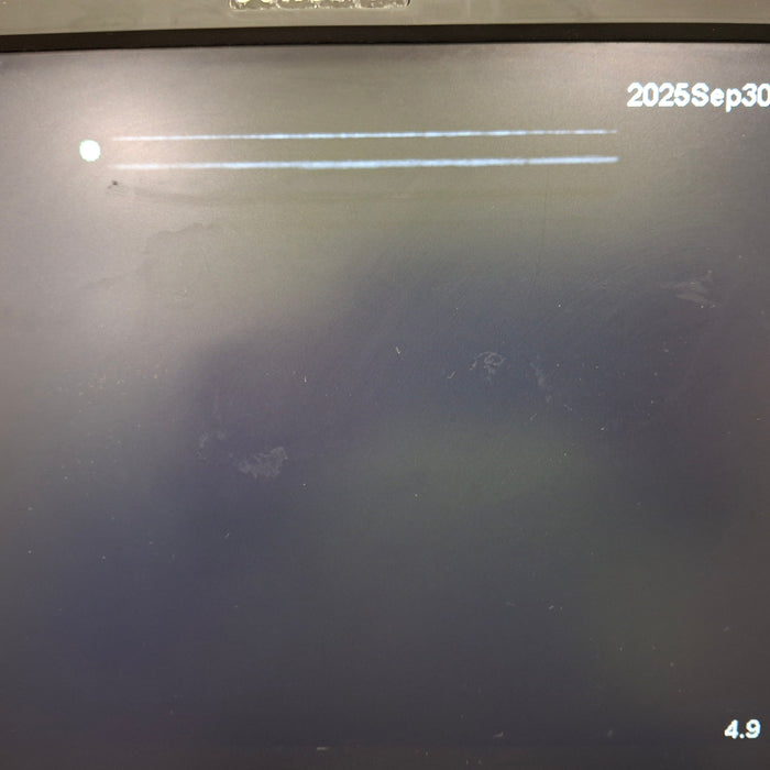 Sonosite Edge Ultrasound