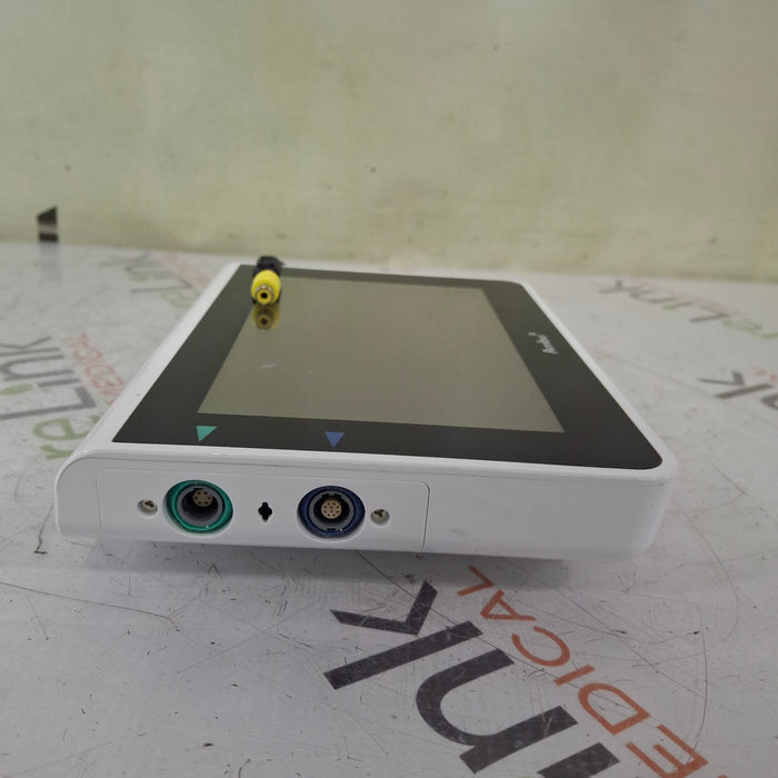 Ambu aView Advance Monitor