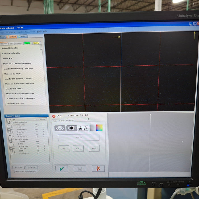 OptoVue RTVue 100 OCT Retinal Scanner