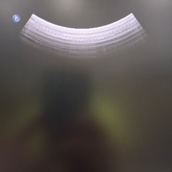 Philips C5-1 Curved Array Transducer