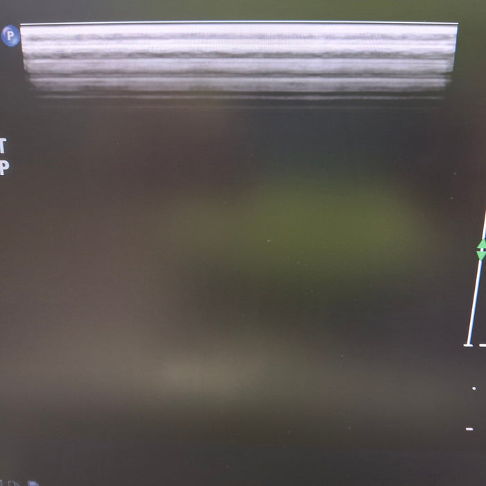 Philips L9-3 Linear Array Transducer