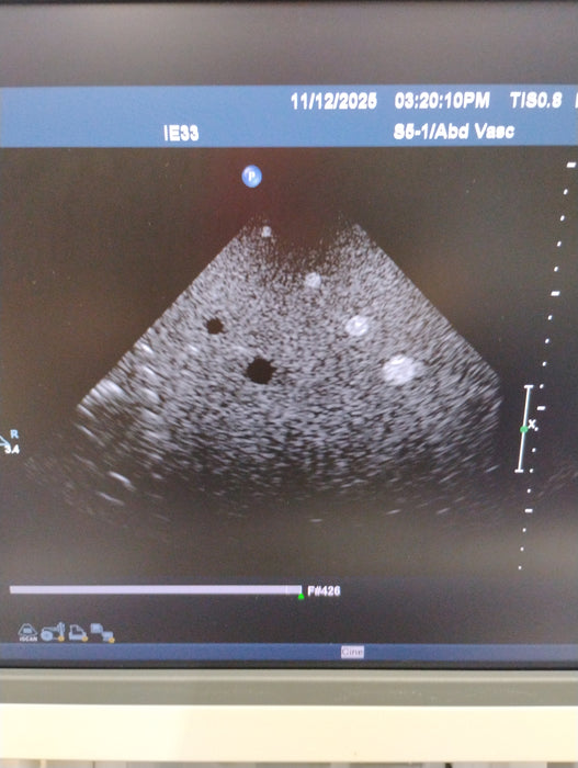 Philips IE33 F-G Cart Ultrasound