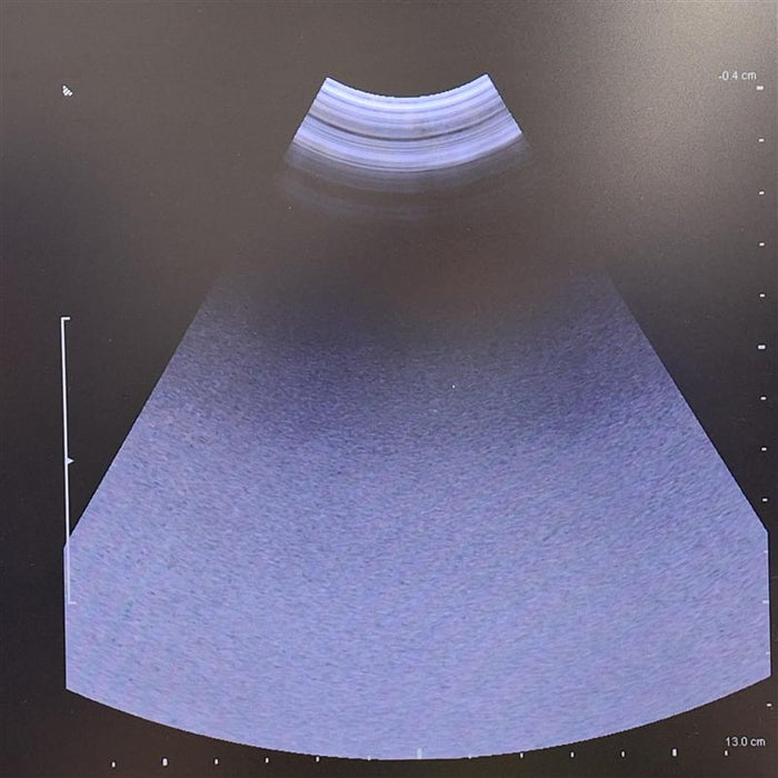 B-K Medical 8823 2-6 MHz Curved Transducer