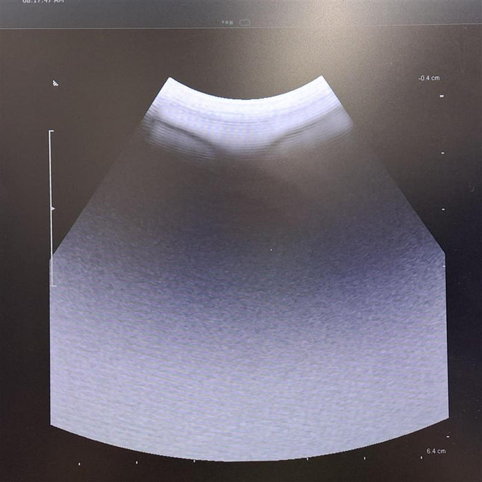 B-K Medical 8862 10-3.8MHz Ultrasound Transducer Probe