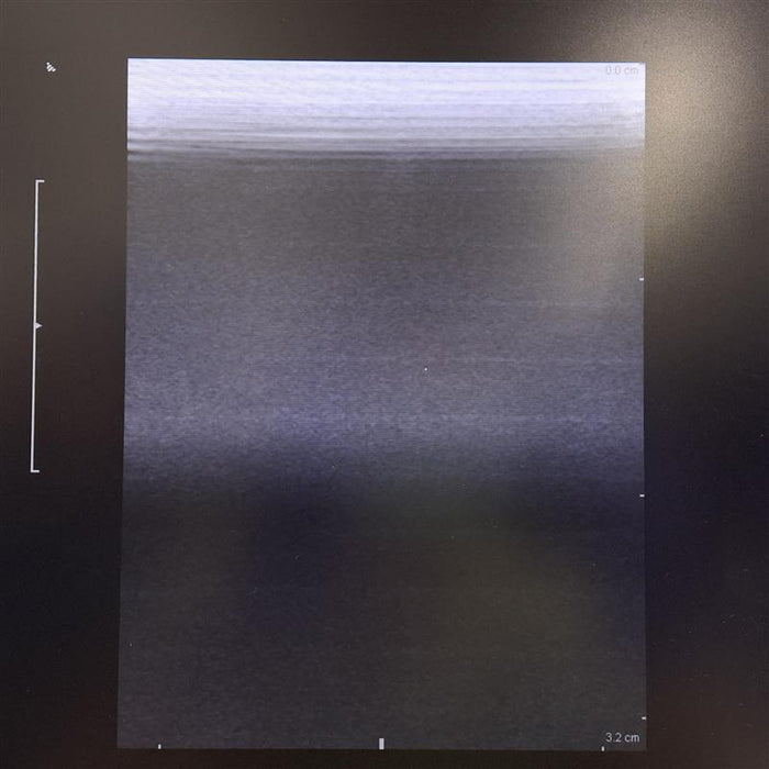 B-K Medical 8809 6-15MHz Ultrasound Transducer