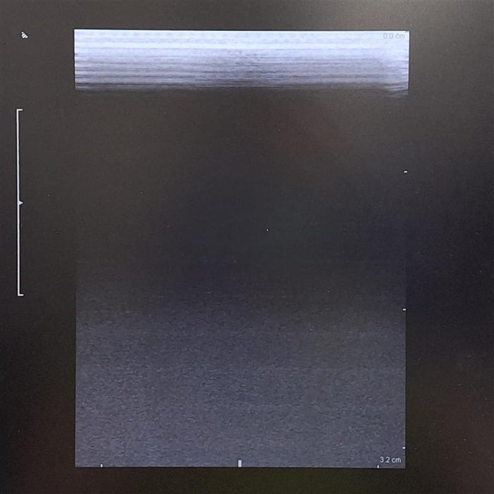 B-K Medical 8809 6-15MHz Ultrasound Transducer