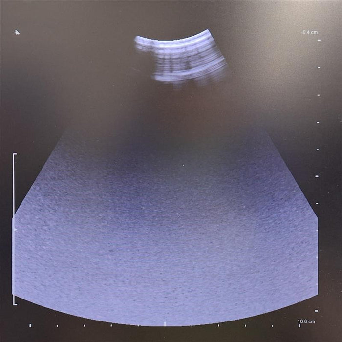 B-K Medical 8823 2-6 MHz Curved Transducer