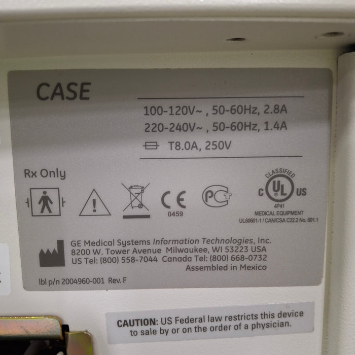 GE Healthcare Case Stress Test Console