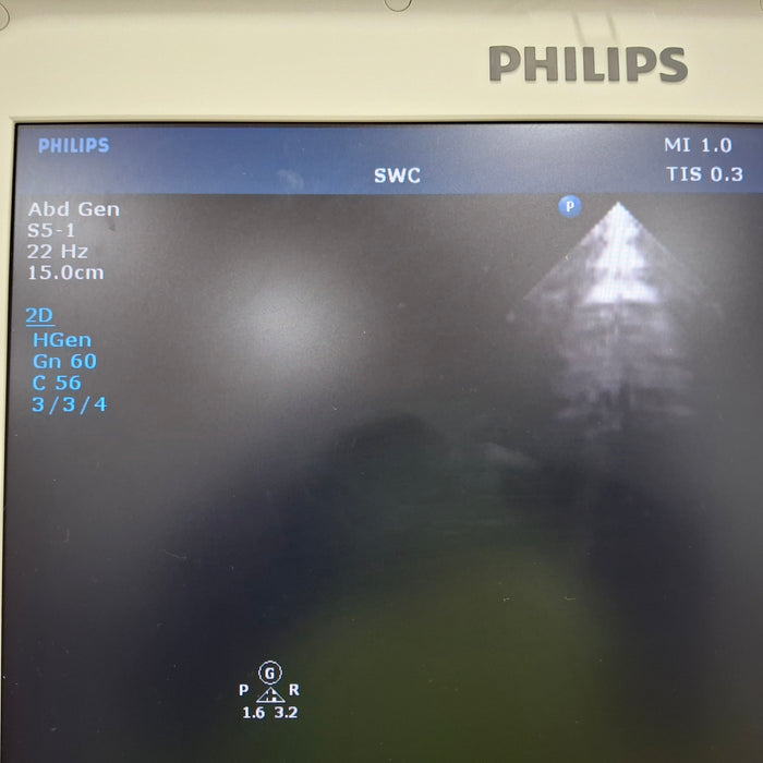 Philips CX50 Ultrasound