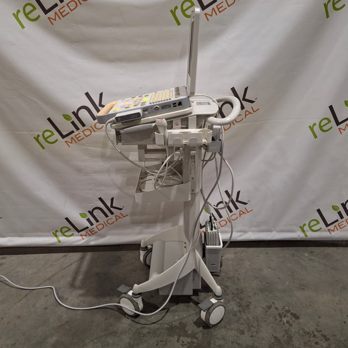 Philips CX50 Ultrasound