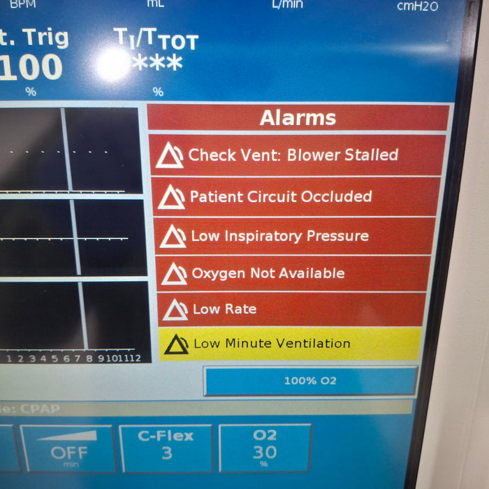 Philips Respironics V60 BiPAP Ventilator