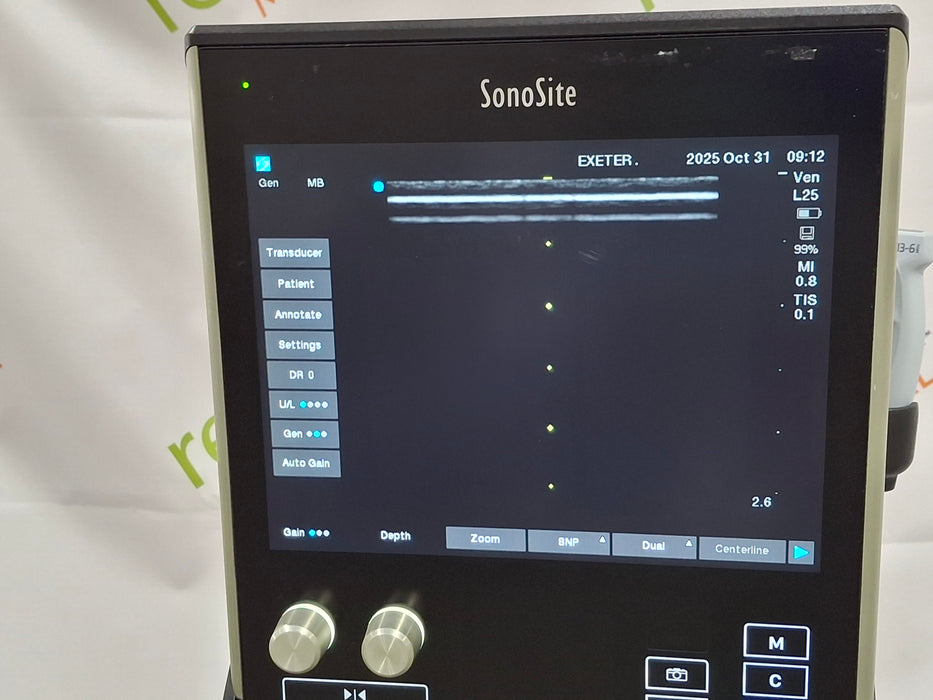 Sonosite SII Ultrasound