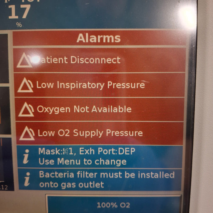 Philips Respironics V60 BiPAP Ventilator