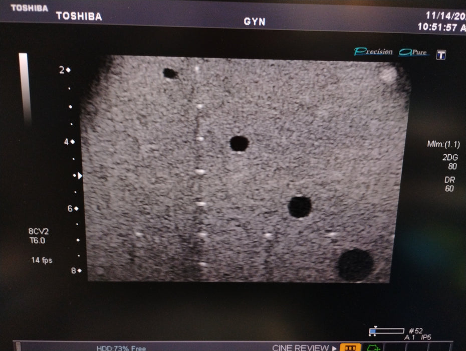 Toshiba PVT-675MV Convex Transducer
