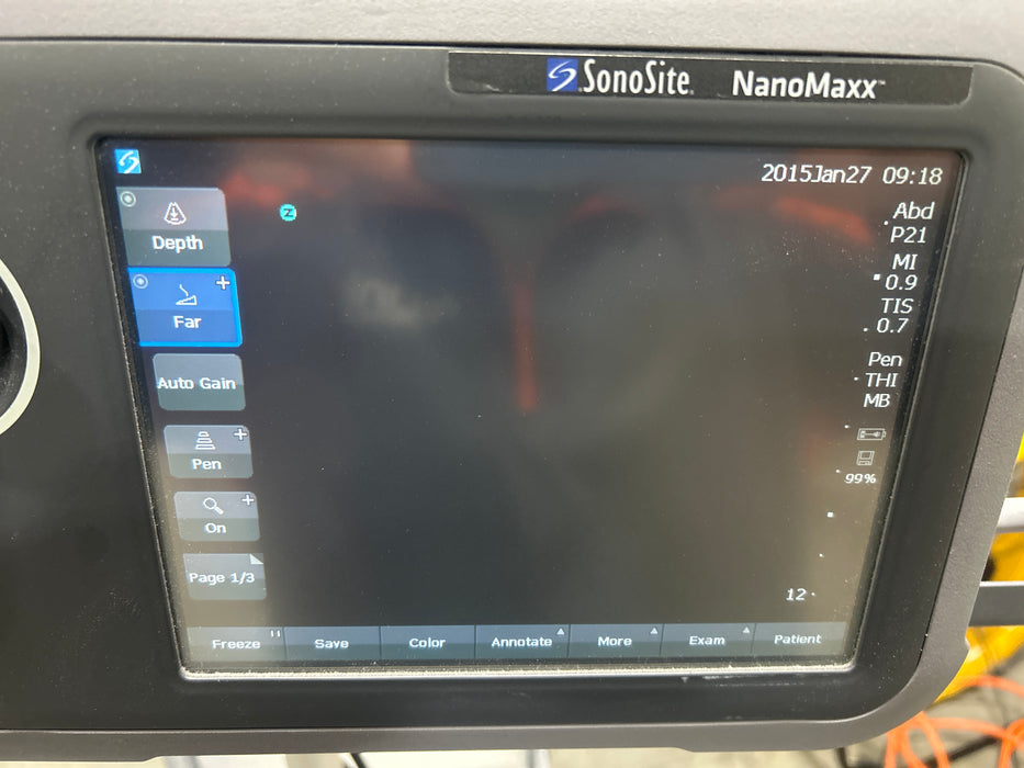 Sonosite NanoMaxx Ultrasound