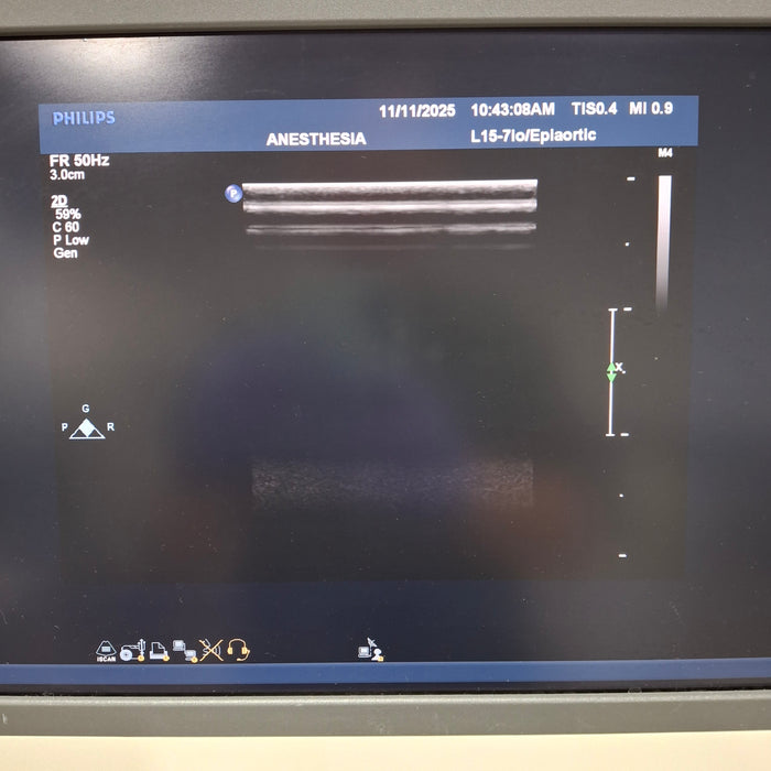 Philips IE33 F-G Cart Ultrasound
