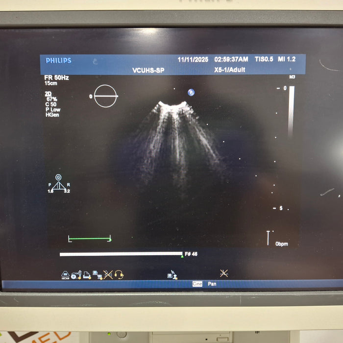 Philips IE33 F-G Cart Ultrasound