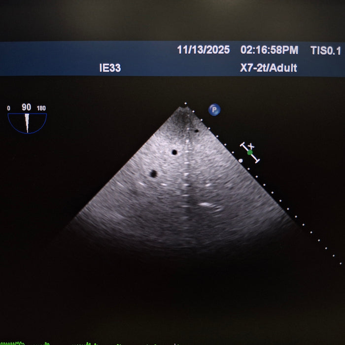 Philips X7-2t TEE Probe Transducer IE33 Version