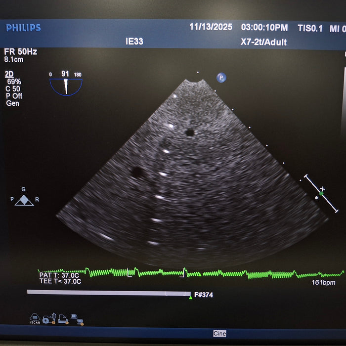 Philips X7-2t TEE Probe Transducer IE33 Version