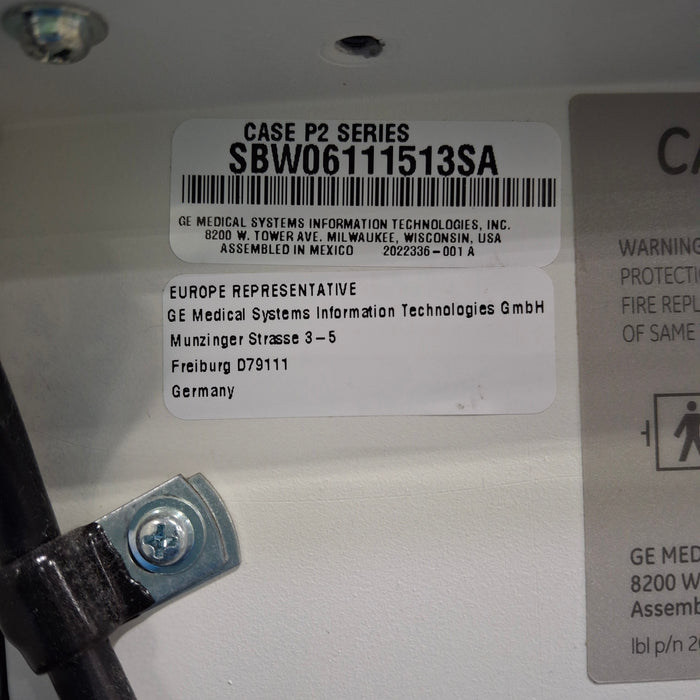 GE Healthcare Case P2 Stress Test Console