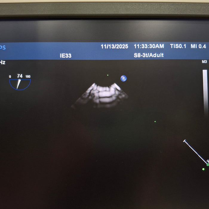 Philips S8-3T Transducer