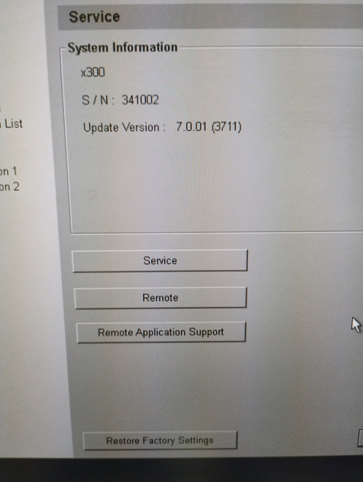 Siemens Acuson X300 Ultrasound