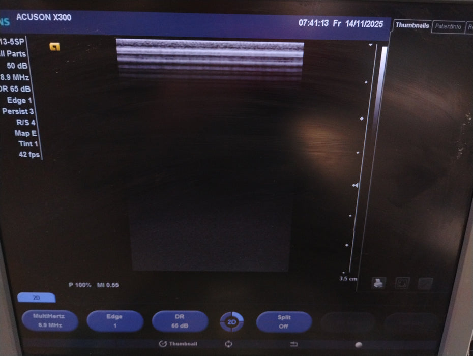 Siemens Acuson X300 Ultrasound